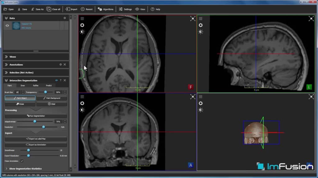 Interactive Medical Imaging